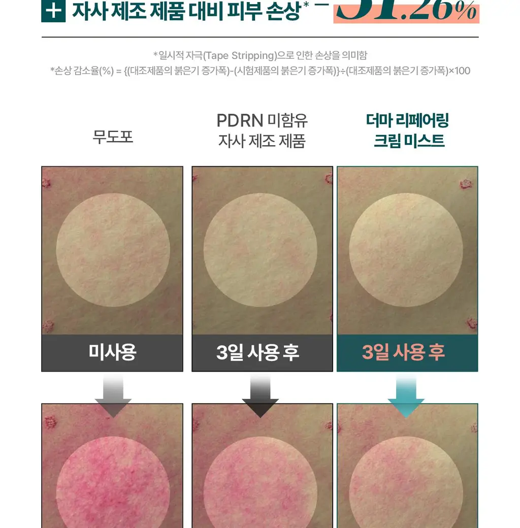 [붉은기 2배 방어_수분 레이어링]리쥬덱스 더마 리페어링 크림 미스트 100ml 상세페이지 9